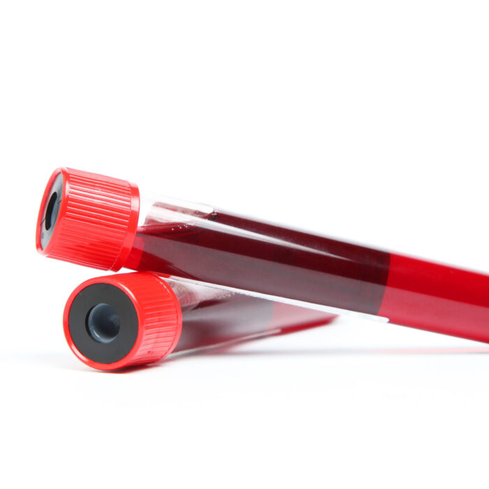 Bloedonderzoek voeding