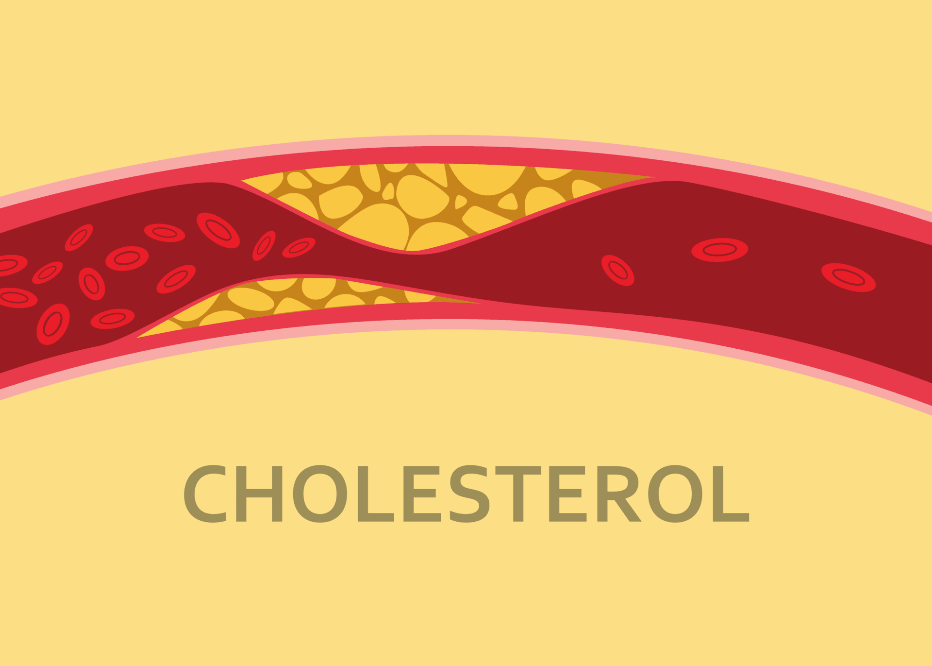 oorzaken symptomen oplossingen cholesterol